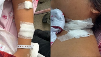 Víctima resultó con graves heridas en el cuello y brazo luego del brutal ataque de su expareja. (Foto composición: Infobae Perú/FB: @Voces)