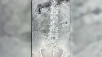 Viajaban en un micro con cápsulas de cocaína en su cuerpo y los descubrieron: los condenaron a 4 años de prisión