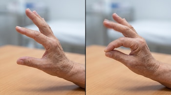 Dos tomas contiguas de una mano apoyada en una mesa, primero con los dedos separados y luego uniendo la yema del índice con el pulgar.