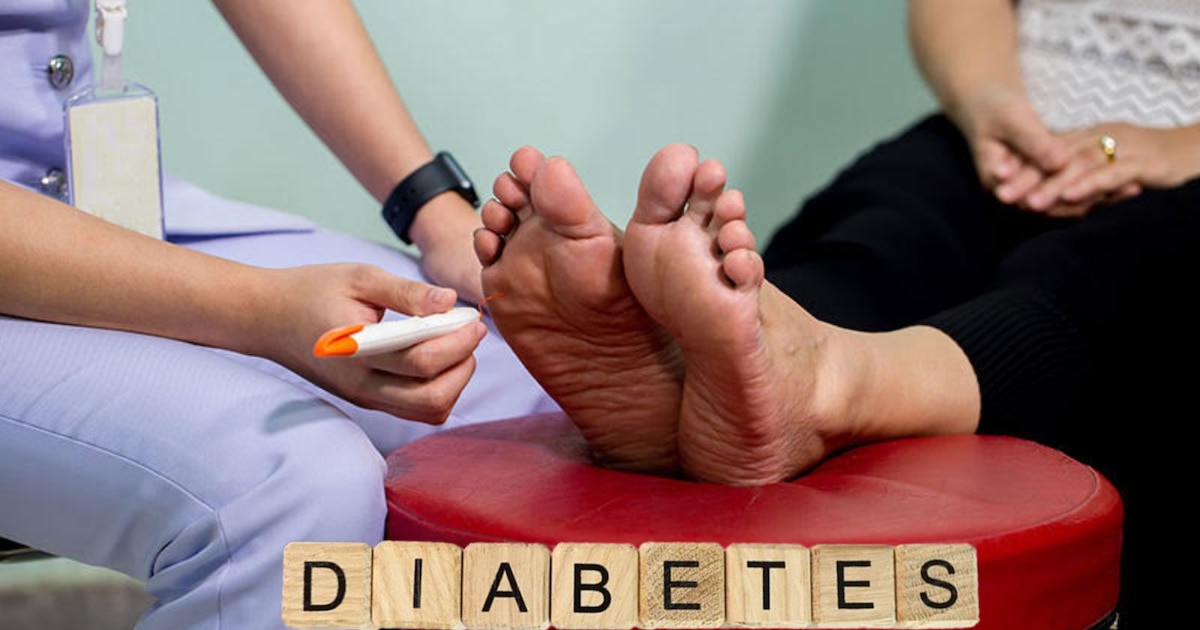 Pie diabético: riesgos, prevención y cuidados esenciales