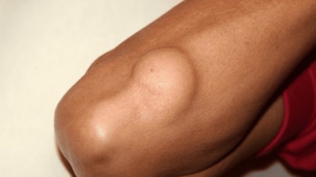 Los bultos de gran tamaño