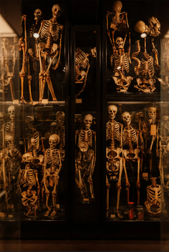 Múltiples esqueletos humanos y fragmentos óseos se exhiben en vitrinas de vidrio con luz tenue. Algunos órganos conservados en frascos son visibles