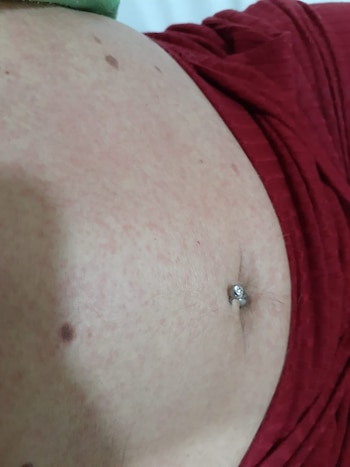 Pensé que tenía covid y me había picado el dengue