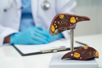 Modelo de hígado graso (AdobeStock)