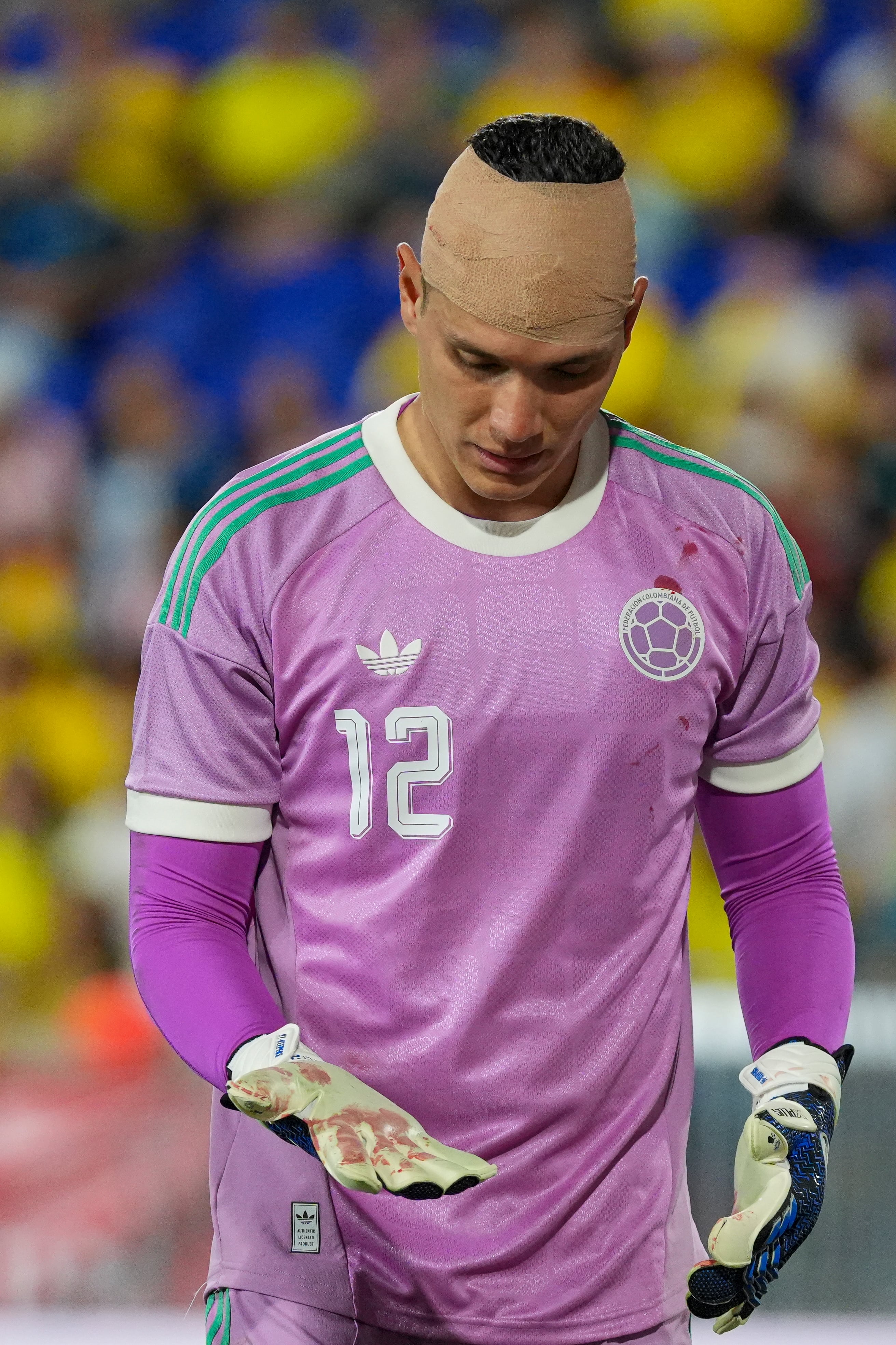 Aldair Quintana luego de recibir el golpe de Hugo Cuenca en el estadio Sports Illustrated en Nueva Jersey (Estados Unidos)-crédito Ángel Colmenares/EFE
