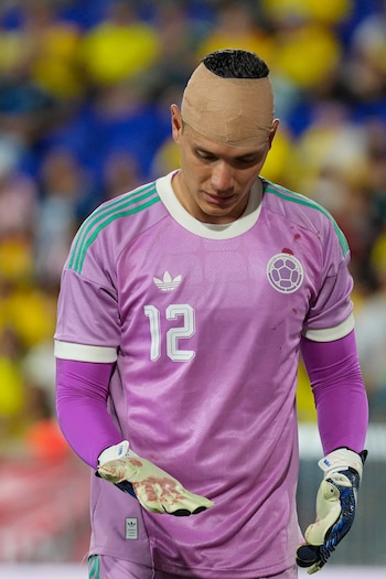 Ángel Colmerares/EFE