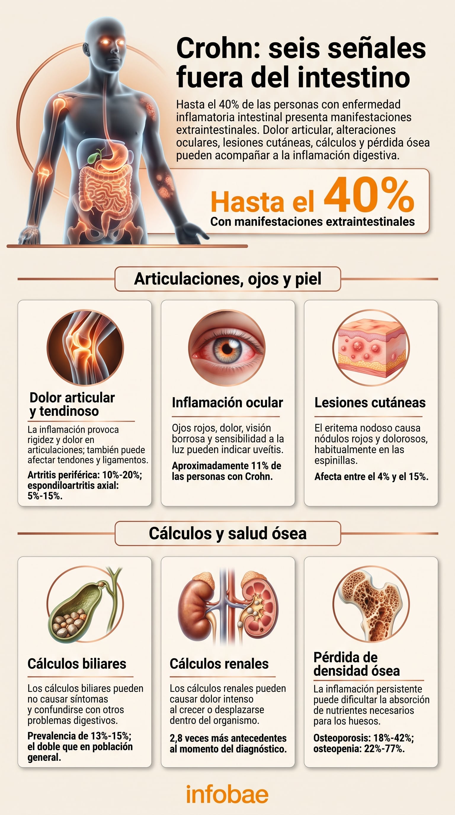 Hasta el 40% de los pacientes con enfermedad inflamatoria intestinal experimenta síntomas fuera del tracto digestivo (Imagen Ilustrativa Infobae)