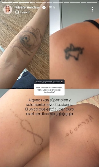 Luisa Fernanda W señaló que algunos diseños son más difíciles de remover, como el tatuaje apodado “el cerdicornio” - crédito luisafernandaw / Instagram