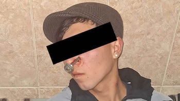 La Matanza: se peleó por el amor de una mujer y le clavaron una llave en la cara