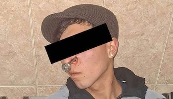 pelea la matanza llave en la cara