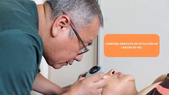 detección del cáncer de piel