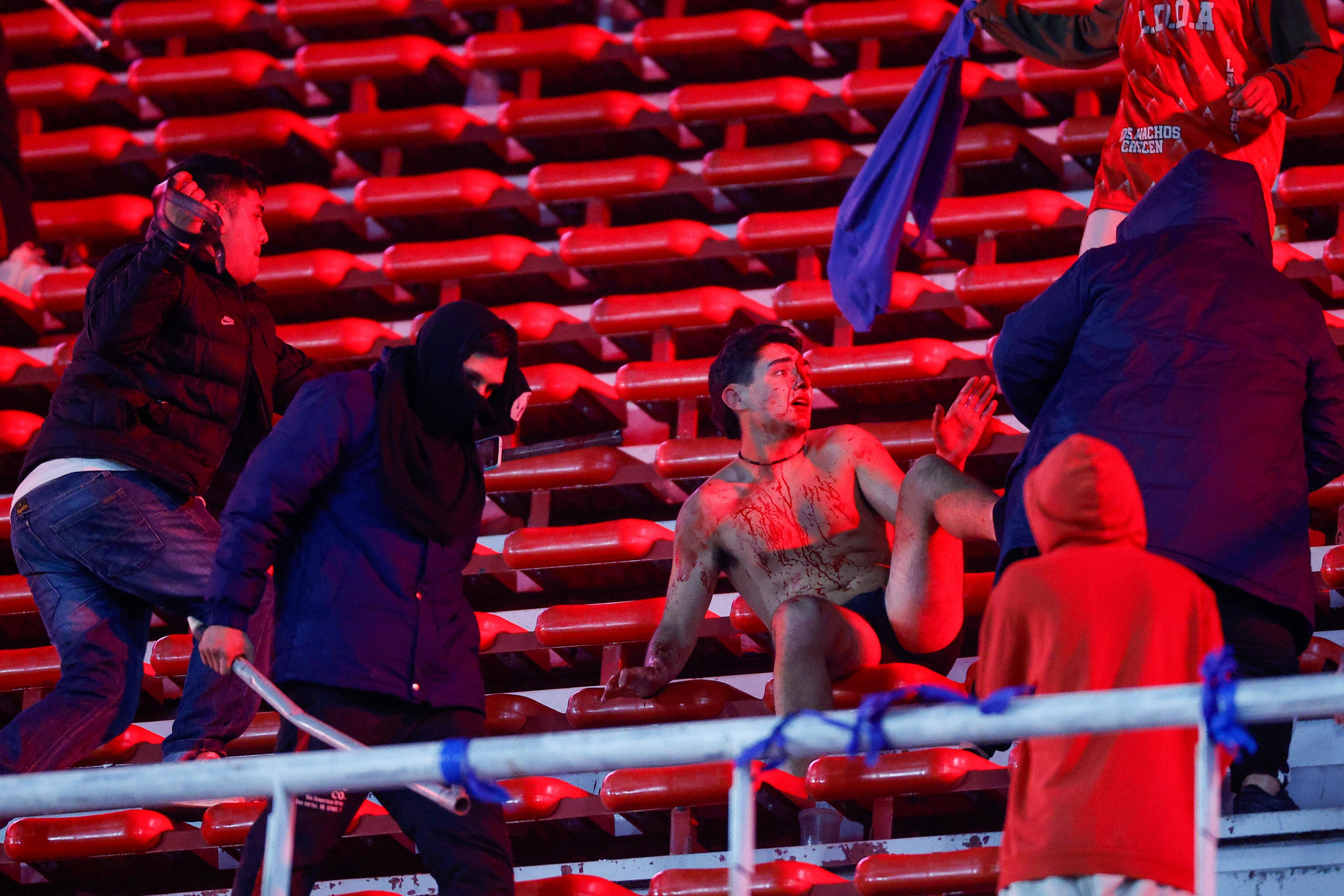 La imagen de un hincha de la U de Chile ensangrentado tras ser golpeado (EFE/ Juan Ignacio Roncoroni)