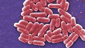 Brote de E. coli: la FDA ordena el retiro de una marca de quesos pero la empresa se niega a sacarlos del mercado