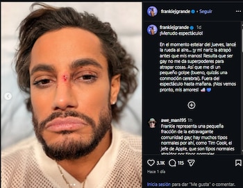 Frankie Grande relató que su rostro sufrió varios golpes.