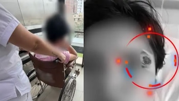 Adolescente de 15 años permanece en UCI tras depilación de cejas en Pueblo Libre: madre denuncia quemadura e infección bacteriana