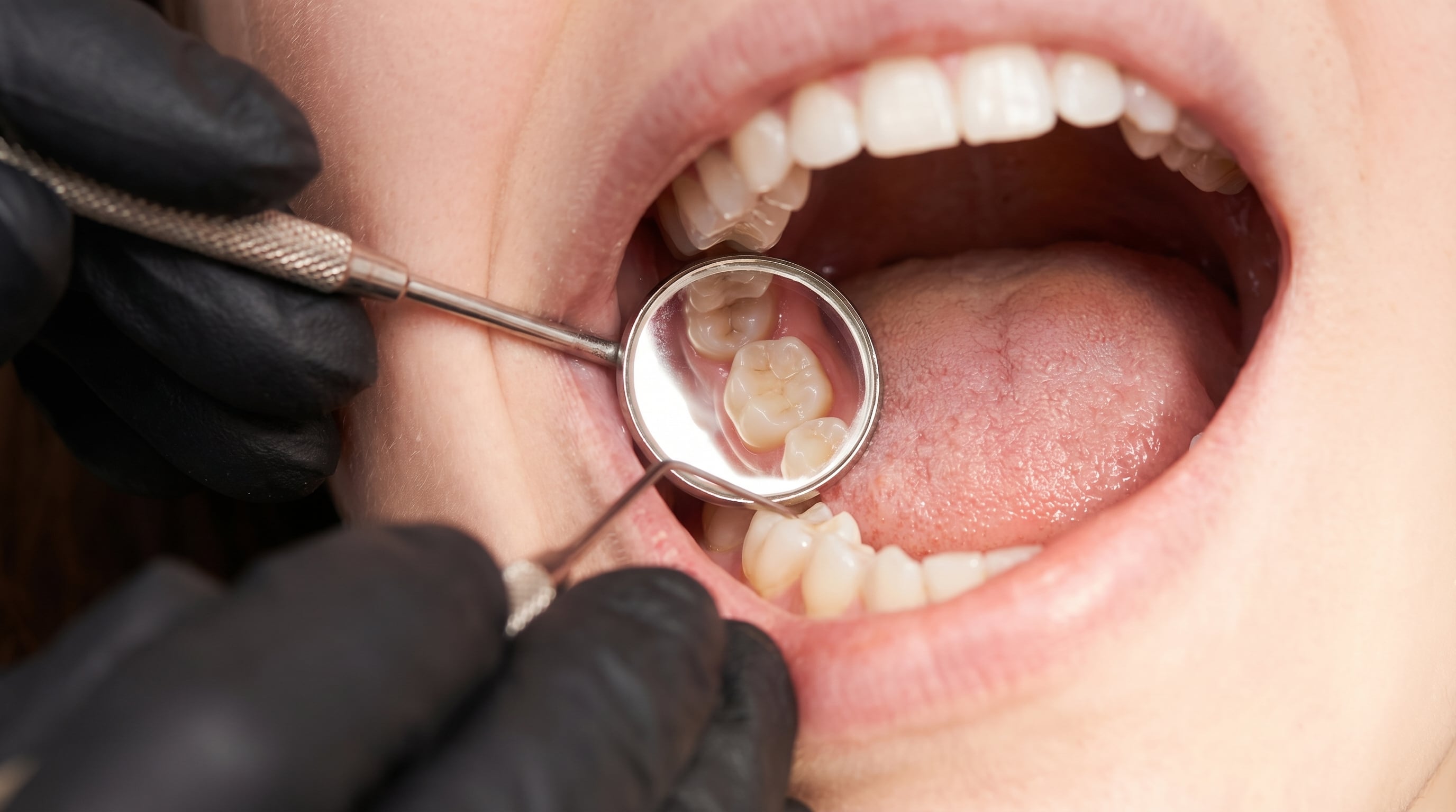 La boca refleja desequilibrios inflamatorios y metabólicos que pueden pasar años ocultos. (Imagen Ilustrativa Infobae)