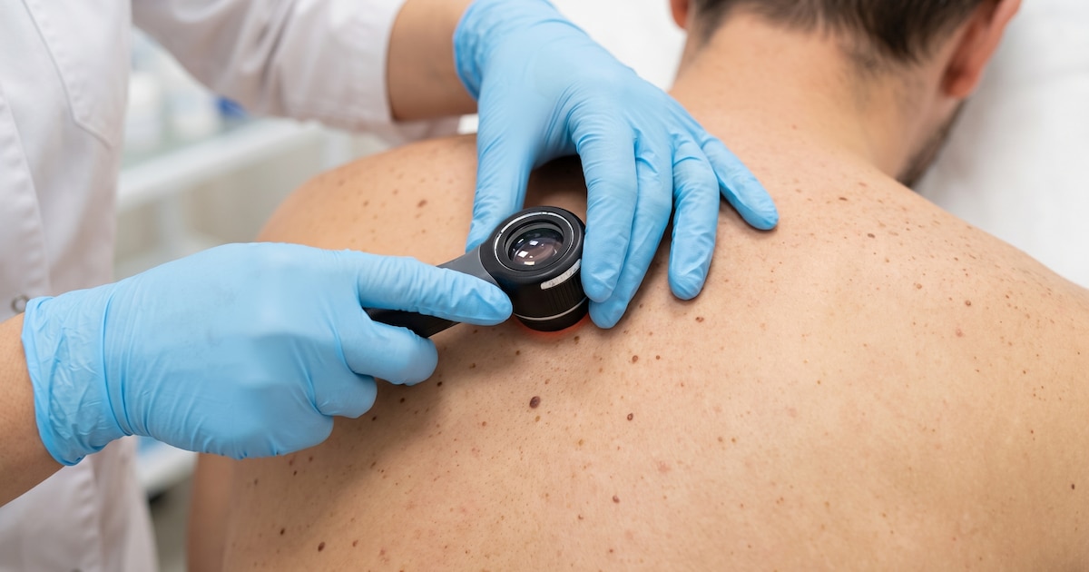Photo: infobae.com Moderna et Merck confirment l'efficacité d'un vaccin à ARNm contre le mélanome