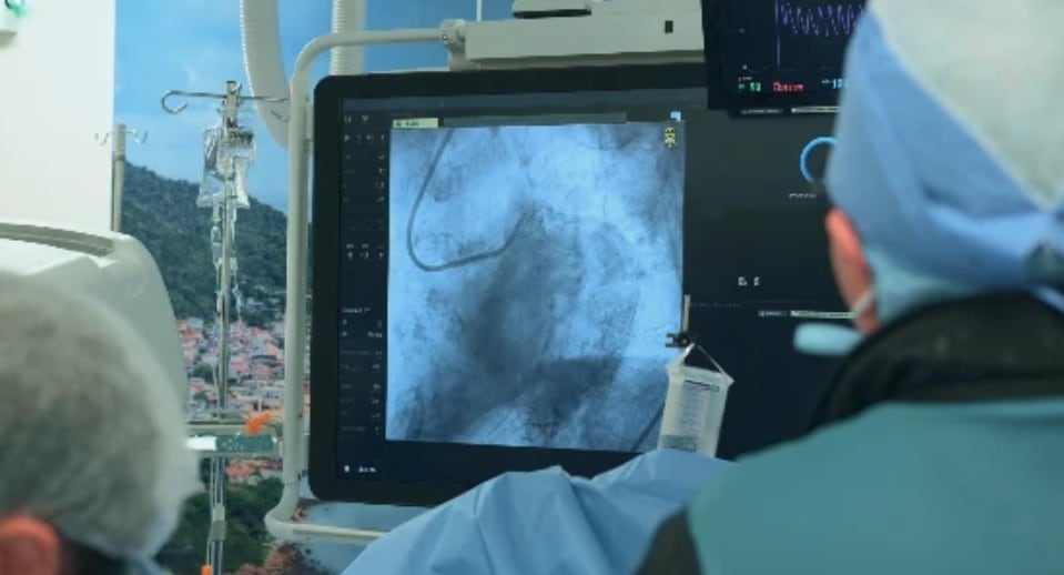 Ochenta pacientes ya recibieron atención gracias a jornadas extraordinarias de cateterismo cardiaco e intervenciones coronarias complejas. (CSS)