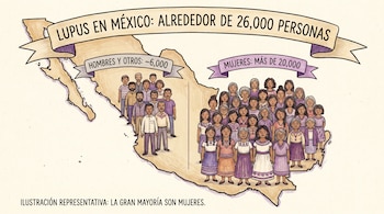 Ilustración del mapa de México con un grupo de hombres a la izquierda y un grupo mucho más grande de mujeres a la derecha, representando las estadísticas de lupus.