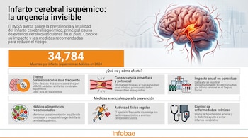 Infografía sobre infarto cerebral isquémico, con ilustración de un cerebro y un coágulo, datos de mortalidad en México y secciones de causas y prevención.