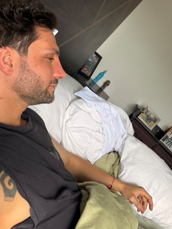 Nicola Porcella en recuperación por su nariz