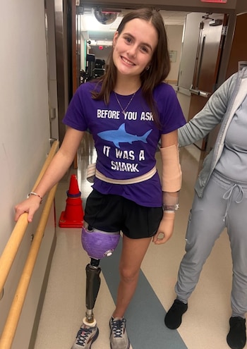 Mujer joven con camiseta morada, prótesis en pierna izquierda y yeso en brazo derecho, sonríe y se apoya en pasamanos de un pasillo