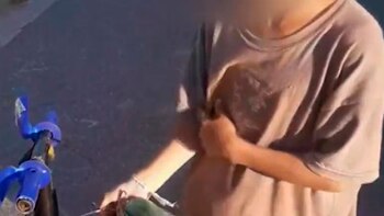 El menor muestra una quemadura