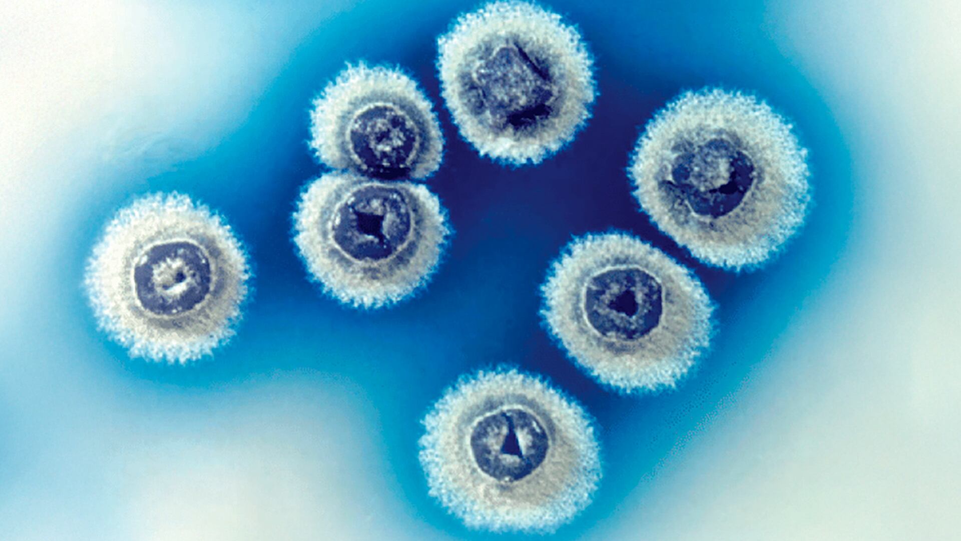 Descubrieron la pre-metilenomicina C lactona, una molécula producida por la bacteria Streptomyces coelicolor con potencial para combatir superbacterias resistentes (K.F. Chater)