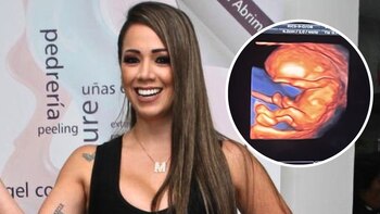 Melissa Klug estaría embarazada de