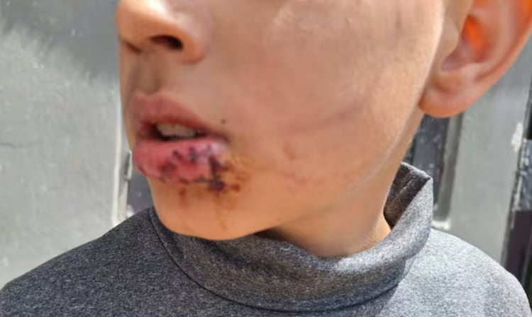 El menor fue atendido en el Hospital de Niños de Córdoba, las lesiones no resultaron graves