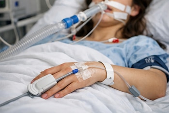 Persona en cama de hospital, intubada con un respirador artificial, vías intravenosas en la mano derecha y un pulsioxímetro en el dedo índice.
