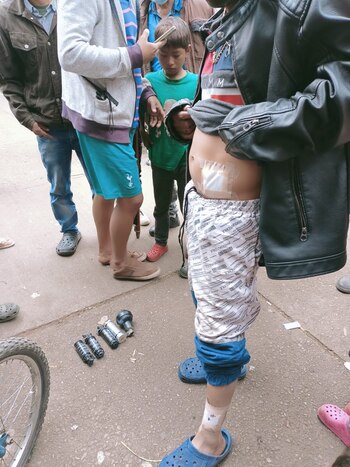 Varios heridos se registran, entre