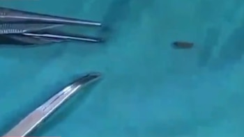 Larvas de mosca caen del