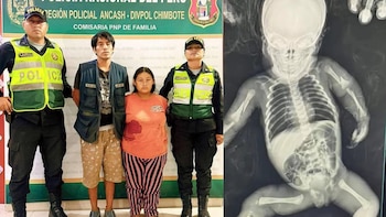 Recién nacida con graves lesiones