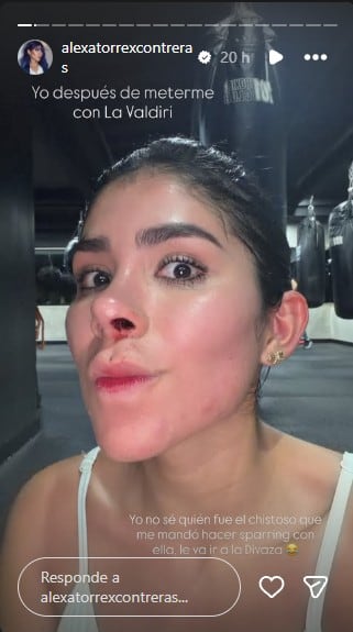 Alexa Torrex presentó sangrado en la nariz después de una sesión de entrenamiento con Andrea Valdiri en Medellín - crédito @alexatorrexcontreras/Instagram