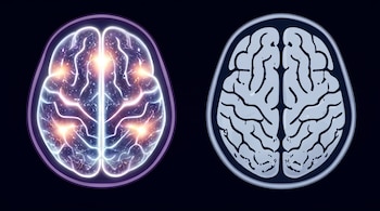 Dos ilustraciones de cerebros humanos en vista superior sobre un fondo oscuro. Un cerebro muestra líneas luminosas y destellos, el otro presenta un contorno anatómico.