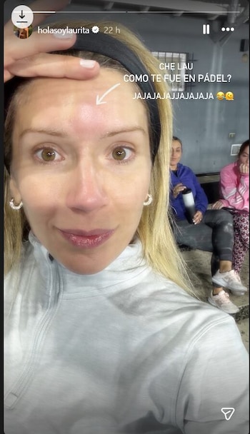 Primer plano de Laurita Fernández con el cabello rubio y una banda negra, mostrando un golpe rojizo e hinchado en el centro de su frente. Lleva una camiseta gris