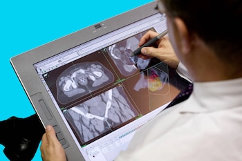 La técnica utiliza una fuente