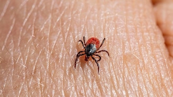 Un farmacéutico explica cómo extraer una garrapata que nos ha picado