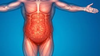 Ilustración 3D de un torso humano, mostrando músculos y una gran acumulación de grasa abdominal de color rojo intenso, sobre un fondo azul claro.
