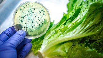 La supervisión de los productos