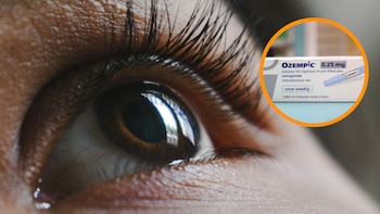 El problema de visión que