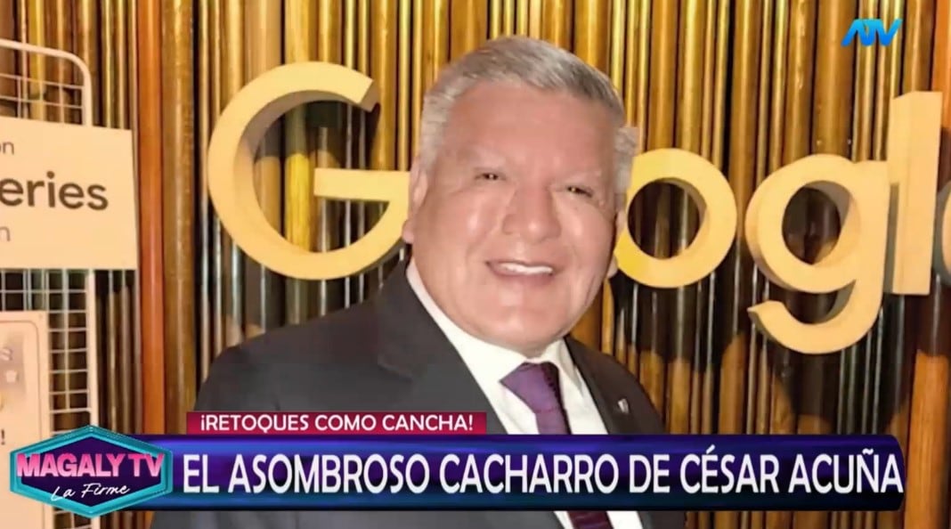 ¿Qué se habría hecho César Acuña en el rostro? Magaly Medina reacciona y especialistas analizan su apariencia. Captura: Magaly TV La Firme.