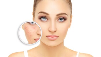 Los probióticos proporcionan una