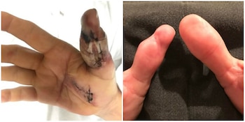 Acudió al hospital y lograron