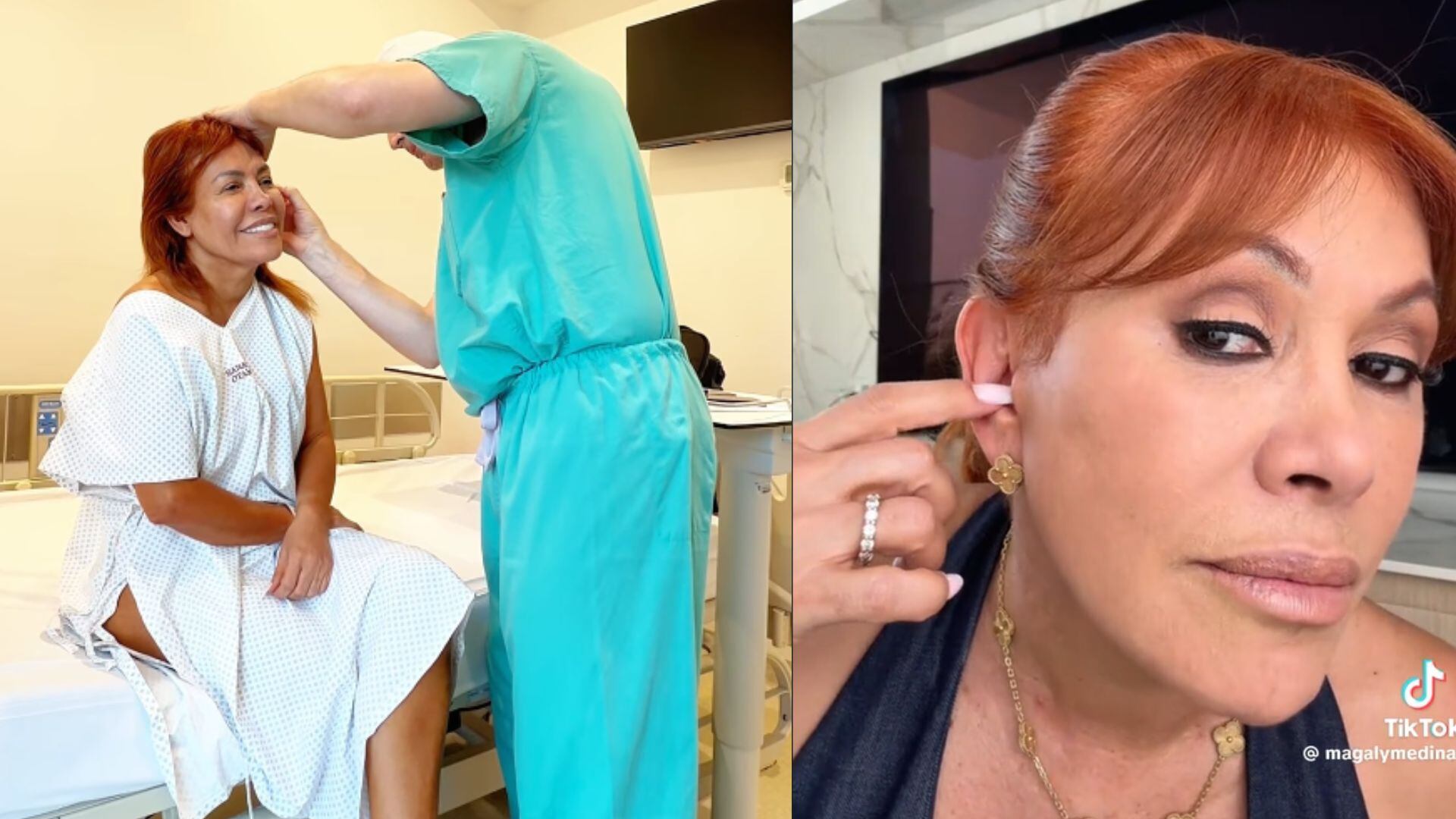La presentadora Magaly Medina, vista antes de su cirugía facial y luego explicando la pérdida de sensibilidad en su oreja, compartió las consecuencias de su intervención estética.