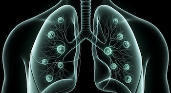 Más allá del tabaquismo, hay