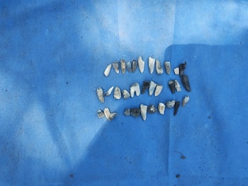 También fueron encontrados restos de dientes (especial)