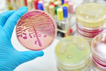 Los autores del estudio señalaron que las diferencias observadas en la diversidad microbiana y en las vías metabólicas de los niños sugieren que los patrones de sueño influyen de manera significativa en la microbiota intestinal y la salud cognitiva (Getty)