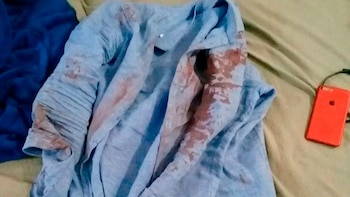 La camisa del atacante secuestrada